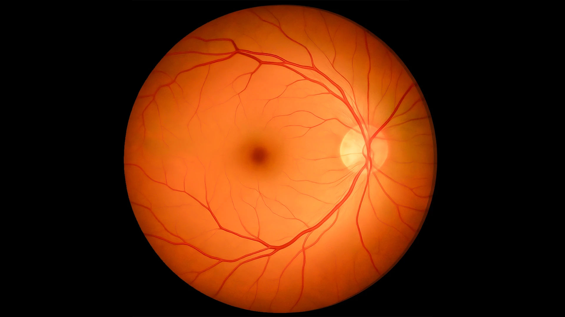 Fundus